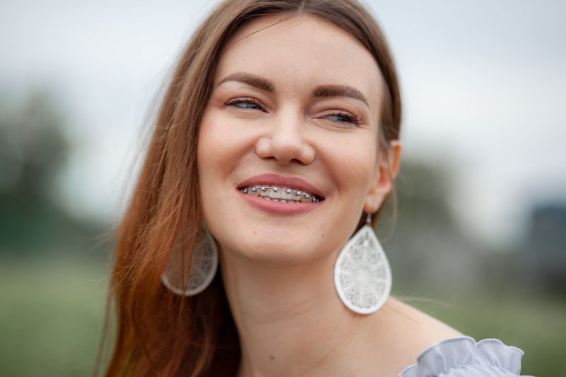 Smile of a beautiful girl with traditional metal braces on her teeth in Moberly, MO